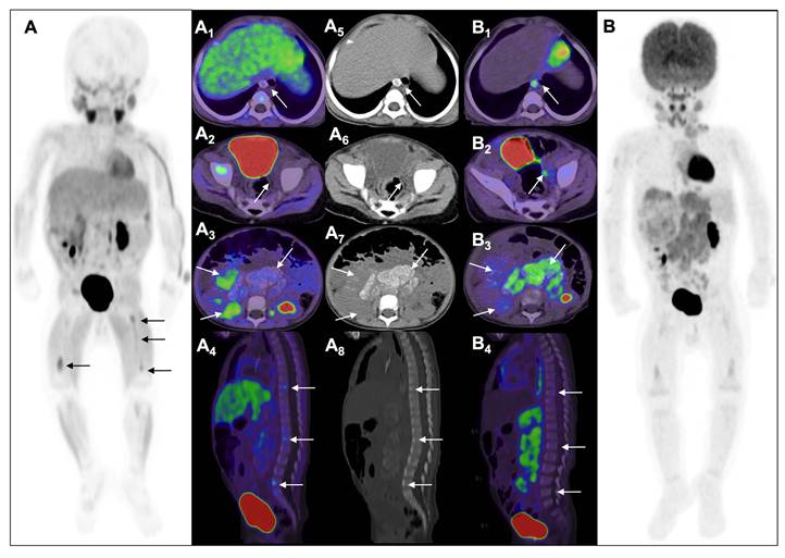 Theranostics Image