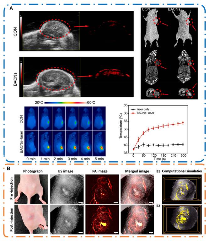 Theranostics Image